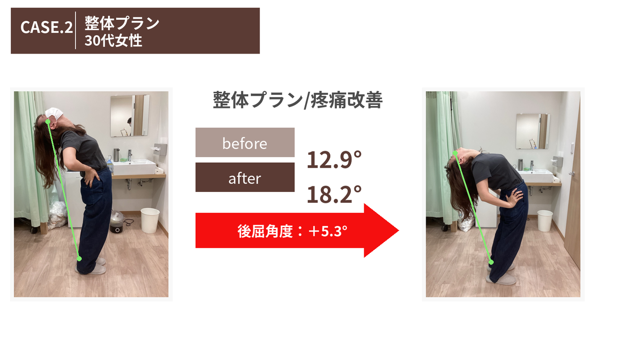 腰痛で整骨院に通った結果