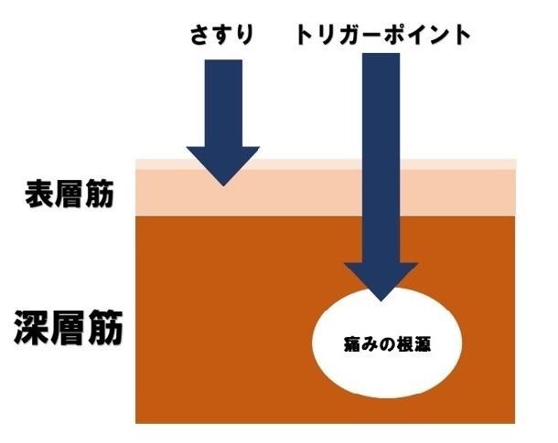 深層筋リリースによる本格手技施術風景　ふじみ野市上福岡　美容整骨院