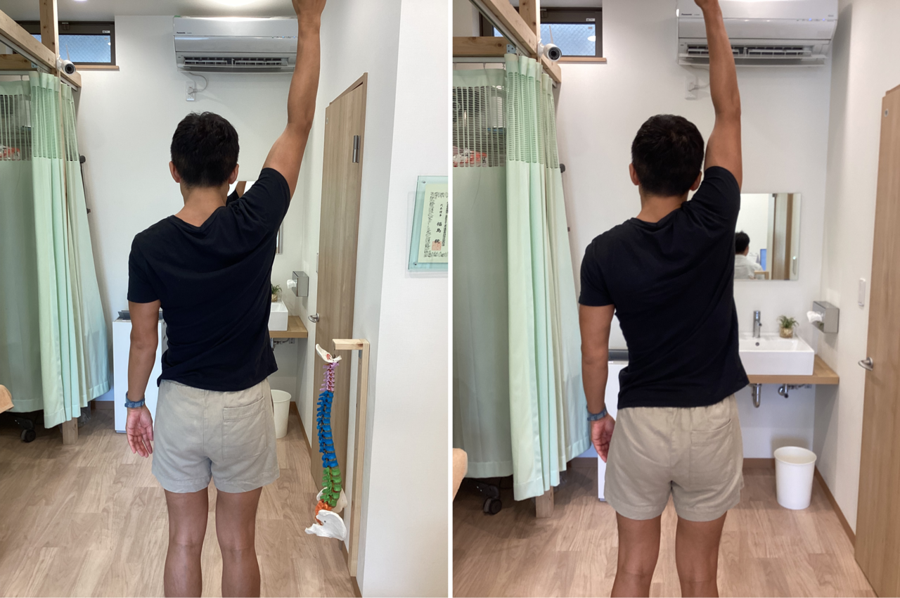 「施術前の姿勢ゆがみ測定　猫背・反り腰の歪みが見られる上福岡みつばち美容整骨院ビフォー写真」